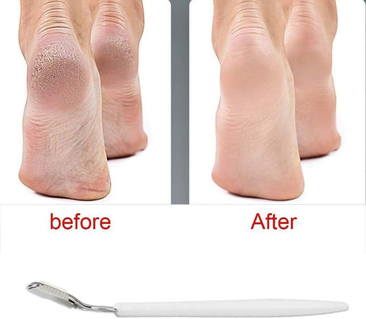 Ever Ready Corn & Callus Plane – Hard Skin Remover Tool | Smooth Feet Fast